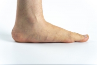 Flexible Flat Feet